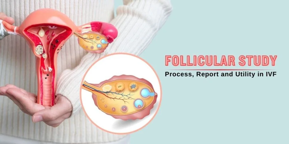 Follicle Monitoring