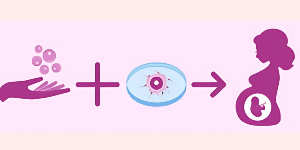 Donor IVF Program