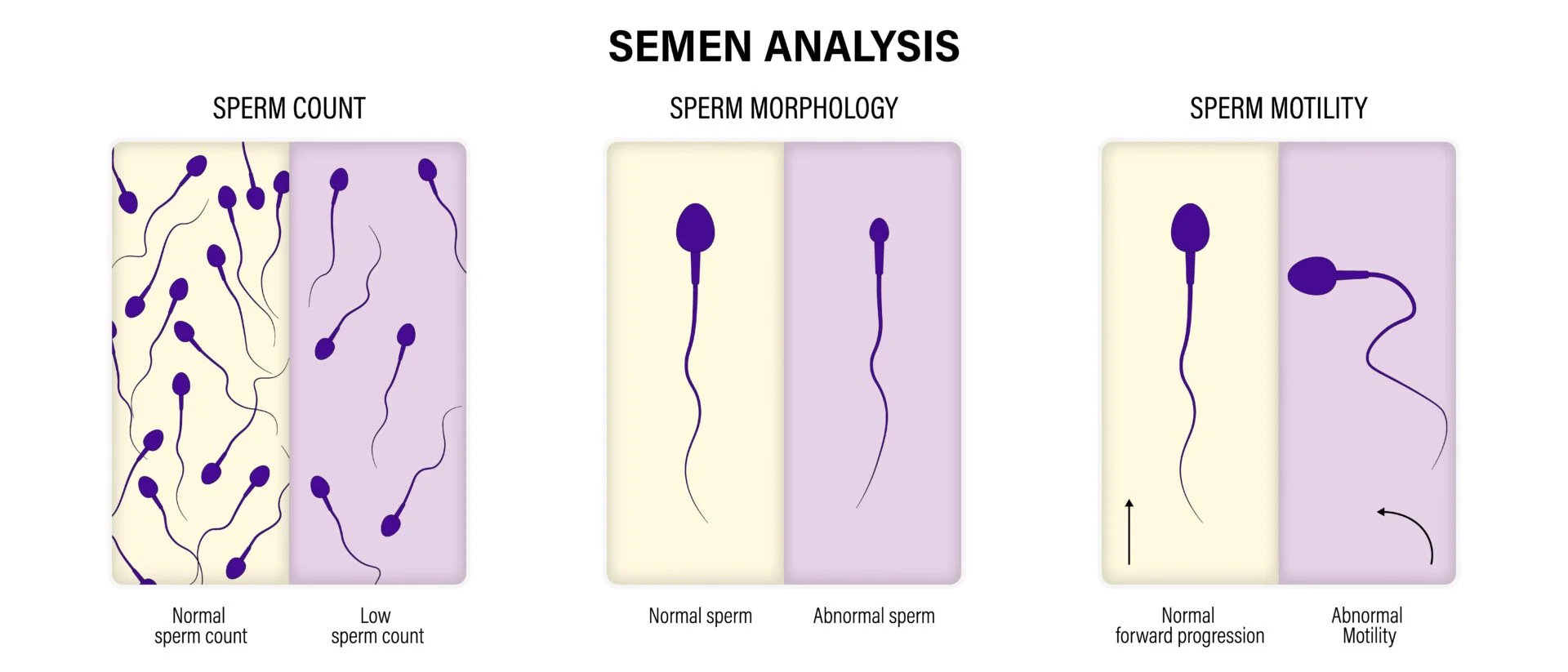 Semen Analysis